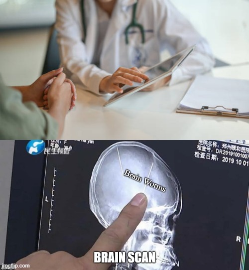 腦子進蟲了（Brain Worms）