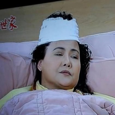 風水世家 - 頭髮骨折